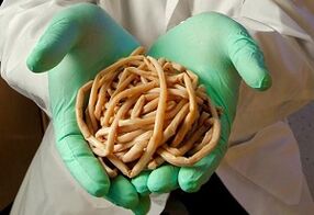 Come i vermi cadono nel corpo umano