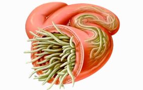 Come pulire l'intestino dei parassiti