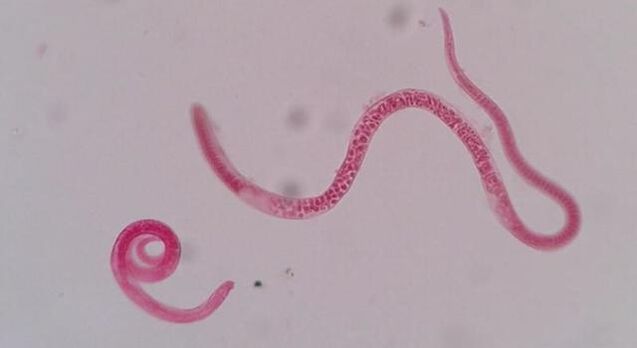 Che aspetto hanno le trichine